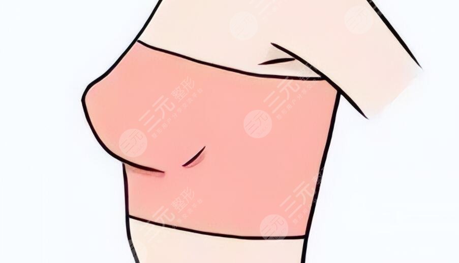 做了假體隆胸會(huì)不會(huì)癌變？乳腺專家跟蹤調(diào)查后總結(jié)~
