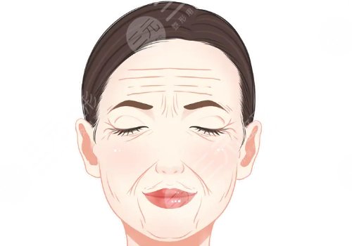 筋膜提升術(shù)多少錢？
