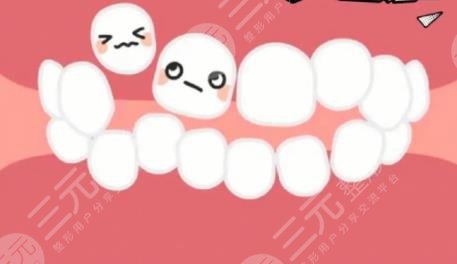牙齒矯正