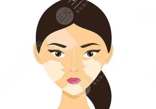 用什么土方治白斑？