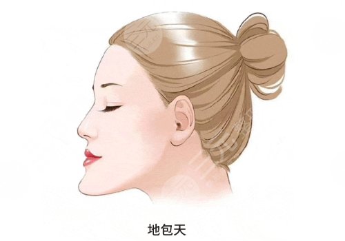 成人地包天手術(shù)整形費(fèi)用多少