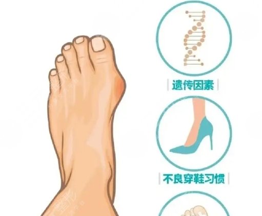 大腳骨