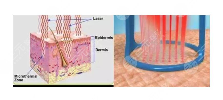 用什么土方治白斑？