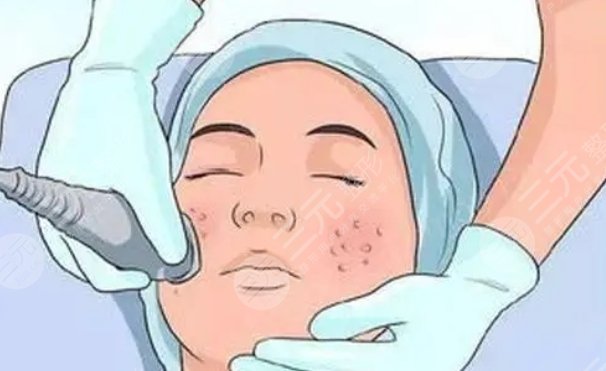 上海華山醫(yī)院祛斑案例