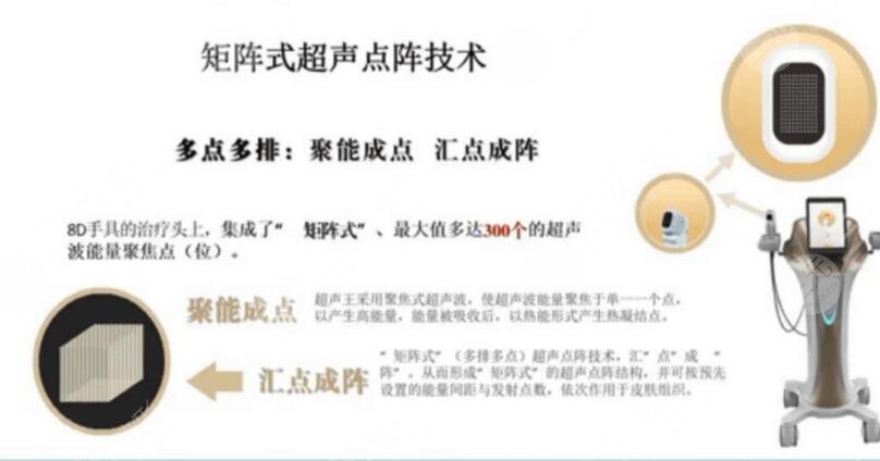 尖峰之星超聲王多少錢？