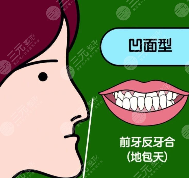 成人地包天手術(shù)整形費(fèi)用多少錢？2023年市場(chǎng)均價(jià)1-3萬不等~