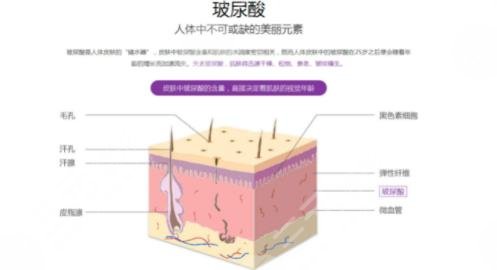 玻尿酸