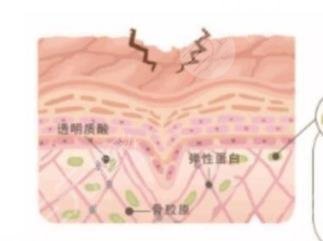 膠原蛋白