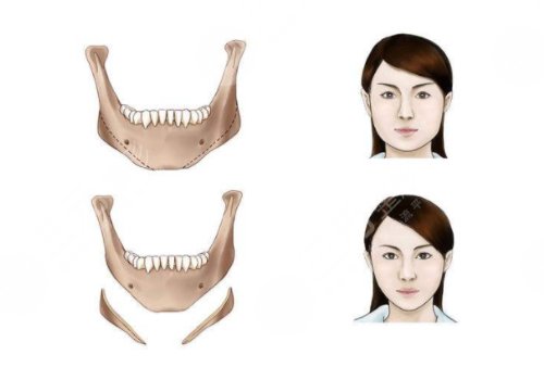北大口腔醫(yī)院頜面外科專家排行