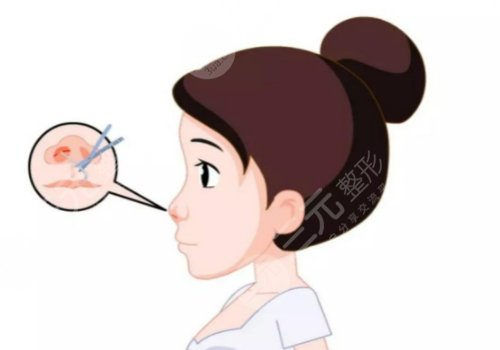 昆明嬌點(diǎn)做鼻子的醫(yī)生有哪些