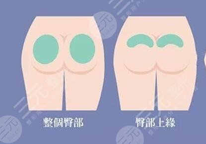 豐臀