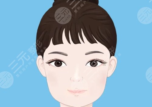 樸一飛醫(yī)生雙眼皮案例