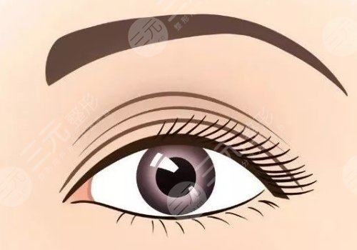 樸一飛醫(yī)生雙眼皮案例