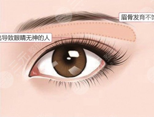 眉弓填充