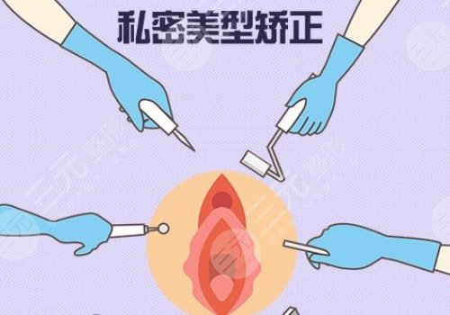 緊縮手術(shù)是怎么做的