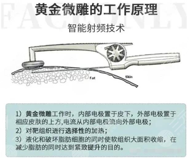 黃金微雕