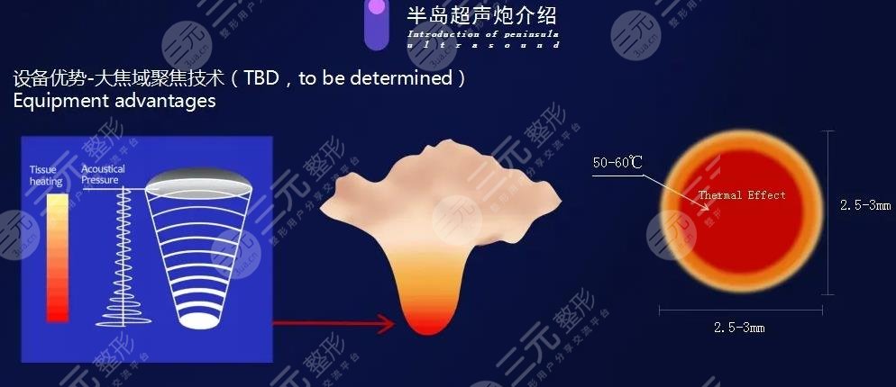 半島超聲炮可以維持多久