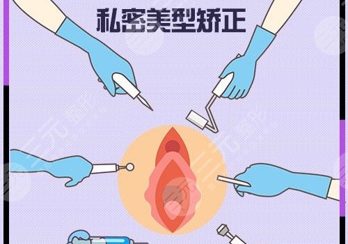 緊縮手術(shù)怎么做多少錢