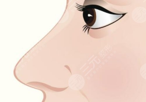 莊蔚強(qiáng)半勒鼻綜合后期恢復(fù)怎么樣