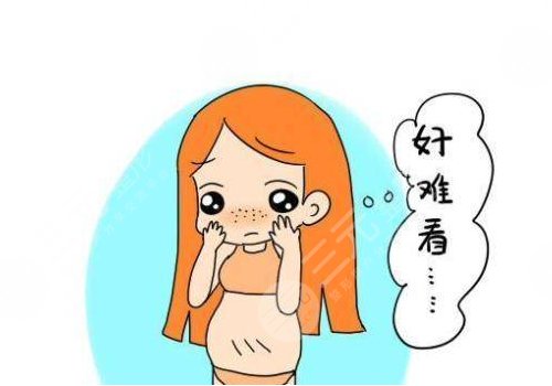妊娠紋什么時候開始出現(xiàn)
