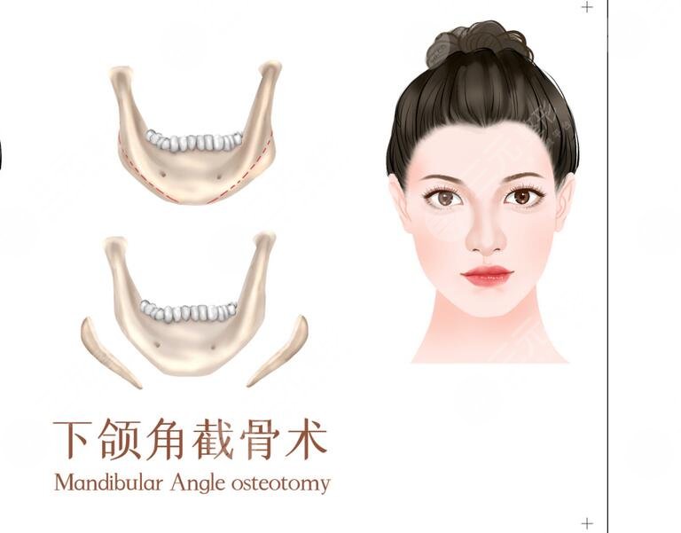 王旭東醫(yī)生怎么樣?