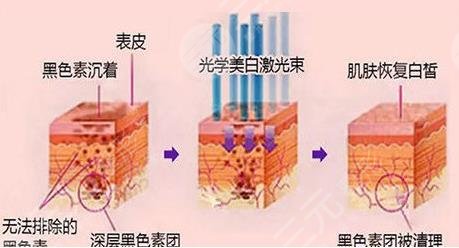 黑眼圈是什么原因造成的