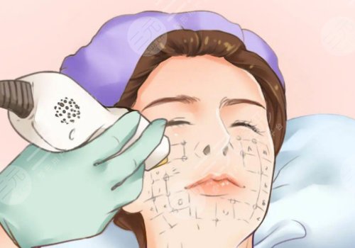 光電抗衰有沒(méi)有副作用？