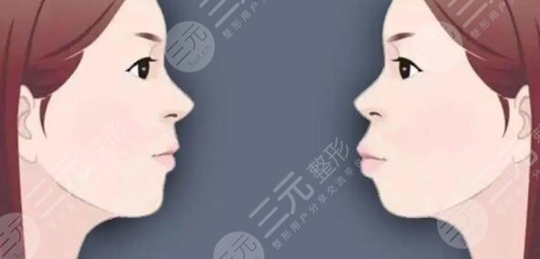 華西口腔醫(yī)院正頜手術擅長醫(yī)生