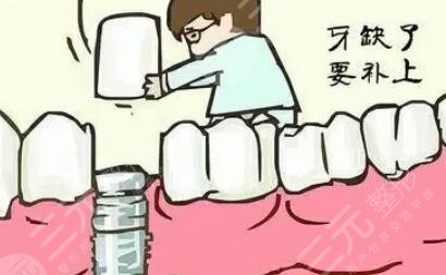 牙齒種植