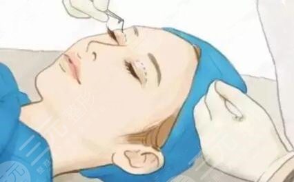 閆迎軍醫(yī)生雙眼皮案例