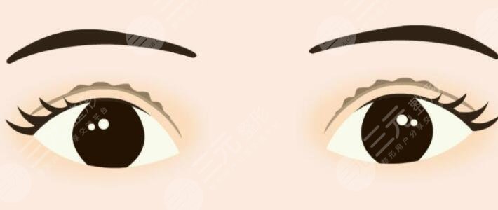 北京閆迎軍醫(yī)生做雙眼皮案例反饋