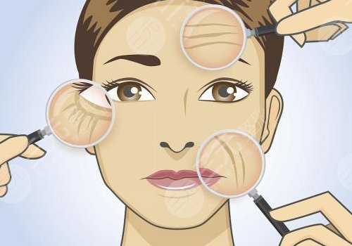 眼部拉皮手術(shù)后會(huì)有哪些后遺癥