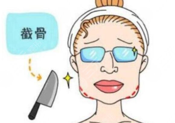下頜角