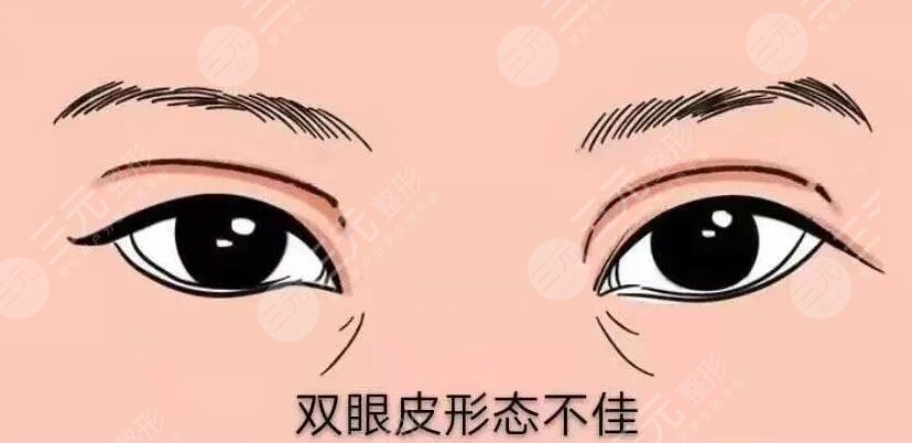 北京韓勛眼修復(fù)案例分享