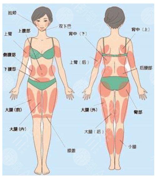 萬哲先抽脂怎么樣?