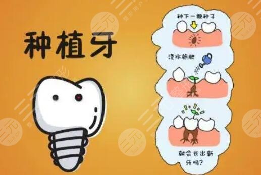 牙齒種植