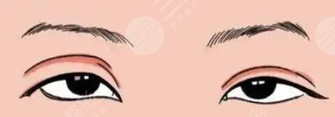 開眼角