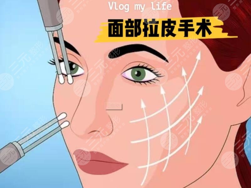 高亞東醫(yī)生拉皮手術(shù)案例真人分享~