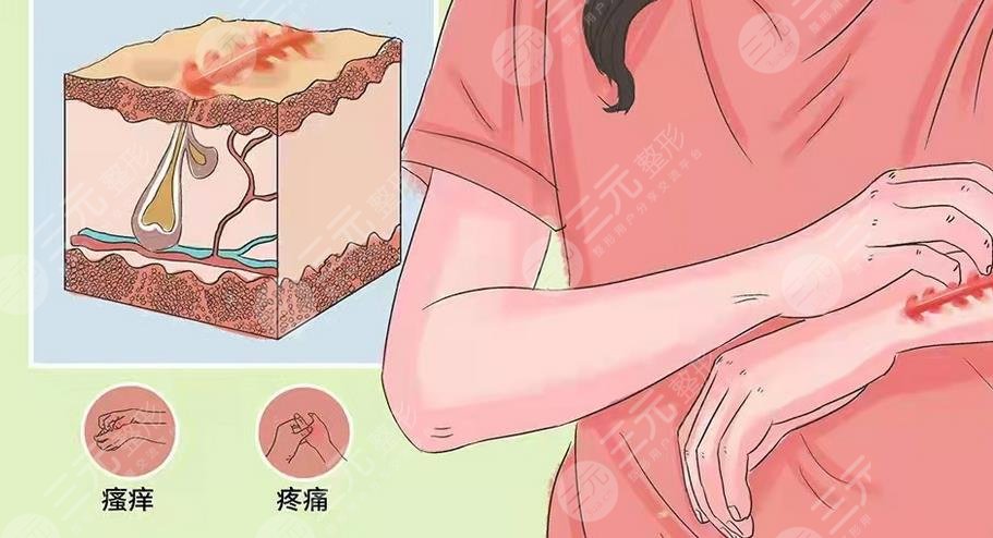 上海第八人民醫(yī)院去疤痕案例分享