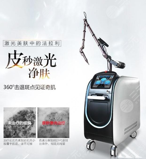 皮秒激光