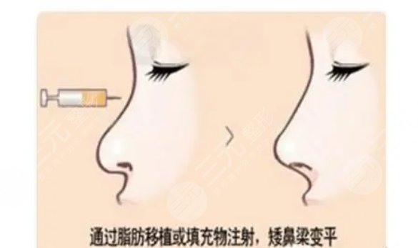 深圳陽(yáng)光醫(yī)療美容醫(yī)院擅長(zhǎng)項(xiàng)目
