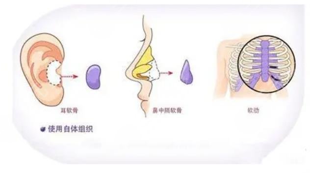 深圳陽(yáng)光醫(yī)療美容醫(yī)院擅長(zhǎng)科普知識(shí)