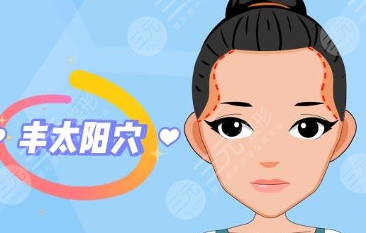 太陽穴填充