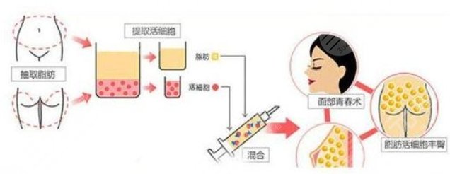 活細胞填充