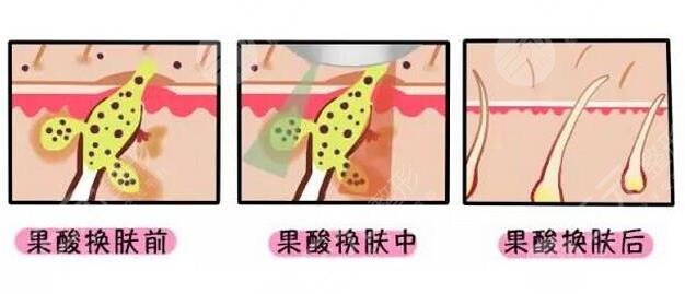  <p style="text-align: center;"> 	<span style="color:#ff0000;"><strong>【想變美嗎？預(yù)約醫(yī)生 獲取優(yōu)惠 點(diǎn)擊 &rarr;咨詢&larr;】</strong></span></p>
