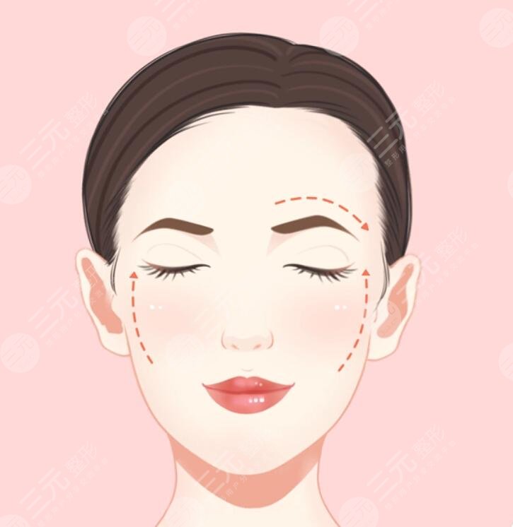 女人做拉皮能管多少年？皮膚科醫(yī)生透露通常維持時(shí)間為3~5年左右
