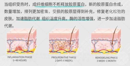 7d聚拉提做一次效果維持多久
