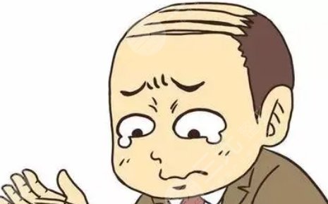 脫發(fā)