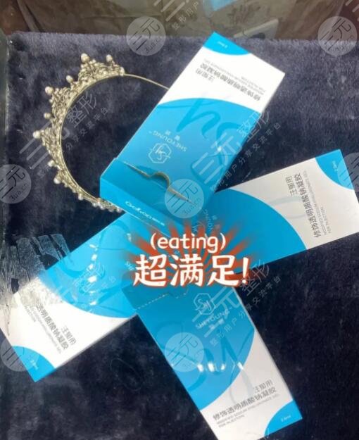 馨妍玻尿酸可以維持多久？注射專家告知通常能保持8~12個月左右