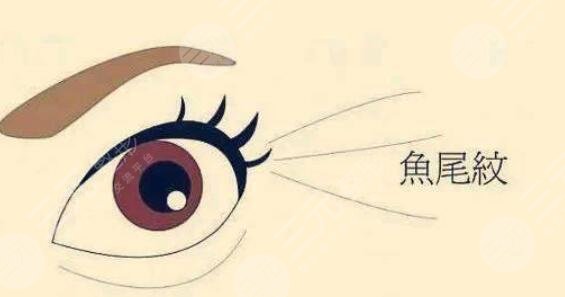 魚尾紋